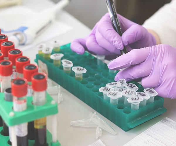 diabete diabetologia esami diagnosi